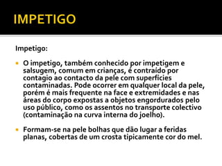 Impetigo: 
 O impetigo, também conhecido por impetigem e 
salsugem, comum em crianças, é contraído por 
contagio ao contacto da pele com superfícies 
contaminadas. Pode ocorrer em qualquer local da pele, 
porém é mais frequente na face e extremidades e nas 
áreas do corpo expostas a objetos engordurados pelo 
uso público, como os assentos no transporte colectivo 
(contaminação na curva interna do joelho). 
 Formam-se na pele bolhas que dão lugar a feridas 
planas, cobertas de um crosta tipicamente cor do mel. 
 