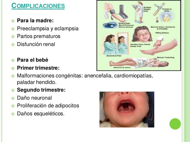Guia alimentar para dm2 diabetes tipo 2 Hijo de madre diabetica y sepsis neonatal