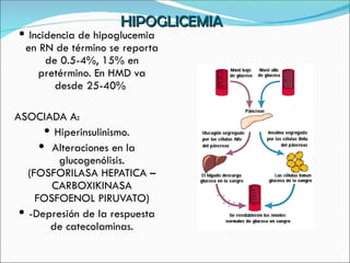 HIPOGLICEMIA Incidencia de hipoglucemia en RN de término se reporta de 0.5-4%, 15% en pretérmino. En HMD va desde 25-40%  ASOCIADA A: Hiperinsulinismo. Alteraciones en la glucogenólisis. (FOSFORILASA HEPATICA – CARBOXIKINASA FOSFOENOL PIRUVATO) -Depresión de la respuesta de catecolaminas. 
