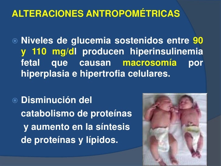 Hijo de Madre Diabética Hijo de Madre Diabética