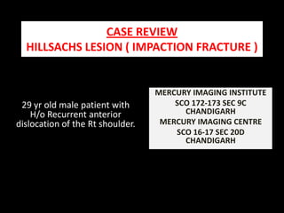 CASE REVIEW                                                       HILLSACHS LESION ( IMPACTION FRACTURE ) MERCURY IMAGING INSTITUTE  SCO 172-173 SEC 9C  CHANDIGARH MERCURY IMAGING CENTRE  SCO 16-17 SEC 20D CHANDIGARH 29 yr old male patient with  H/o Recurrent anterior dislocation of the Rt shoulder. 