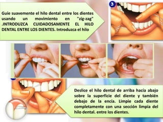 Hilo dental - odontologia preventiva