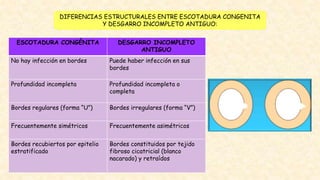 DIFERENCIAS ESTRUCTURALES ENTRE ESCOTADURA CONGENITA
Y DESGARRO INCOMPLETO ANTIGUO:
ESCOTADURA CONGÉNITA DESGARRO INCOMPLETO
ANTIGUO
No hay infección en bordes Puede haber infección en sus
bordes
Profundidad incompleta Profundidad incompleta o
completa
Bordes regulares (forma “U”) Bordes irregulares (forma “V”)
Frecuentemente simétricos Frecuentemente asimétricos
Bordes recubiertos por epitelio
estratificado
Bordes constituidos por tejido
fibroso cicatricial (blanco
nacarado) y retraídos
 