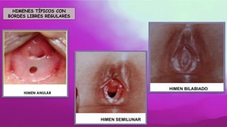 HIMENES TÍPICOS CON
BORDES LIBRES REGULARES
 