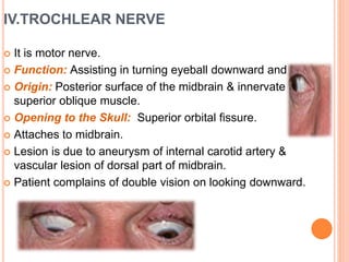IV.TROCHLEAR NERVE
 It is motor nerve.
 Function: Assisting in turning eyeball downward and laterally
 Origin: Posterior surface of the midbrain & innervate the
superior oblique muscle.
 Opening to the Skull: Superior orbital fissure.
 Attaches to midbrain.
 Lesion is due to aneurysm of internal carotid artery &
vascular lesion of dorsal part of midbrain.
 Patient complains of double vision on looking downward.
 