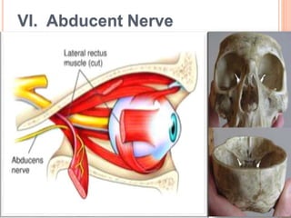 VI. Abducent Nerve
 