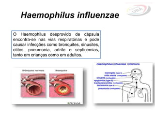 O Haemophilus desprovido de cápsula
encontra-se nas vias respiratórias e pode
causar infecções como bronquites, sinusites,
otites, pneumonia, artrite e septicemias,
tanto em crianças como em adultos.
Haemophilus influenzae
 