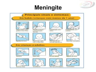 Meningite
 