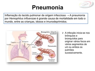 Pneumonia
 A infecção inicia-se nos
brônquios e
bronquíolos para
originar vários focos em
vários segmentos de
um ou ambos os
pulmões
sucessivamente.
Inflamação do tecido pulmonar de origem infecciosa → A pneumonia
por Hemophilus influenzae é grande causa de mortalidade em todo o
mundo, entre as crianças, idosos e imunodeprimidos.
 
