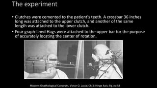 The experiment
• Clutches were cemented to the patient's teeth. A crossbar 36 inches
long was attached to the upper clutch, and another of the same
length was attached to the lower clutch.
• Four graph-lined Hags were attached to the upper bar for the purpose
of accurately locating the center of rotation.
Modern Gnathological Concepts, Victor O. Lucia; Ch 3: Hinge Axis; Pg. no 54
 
