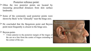 Refrence Point Photo hinge axis and facebow in prosthodontics | PPTX