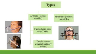 hinge axis and facebow in prosthodontics | PPTX