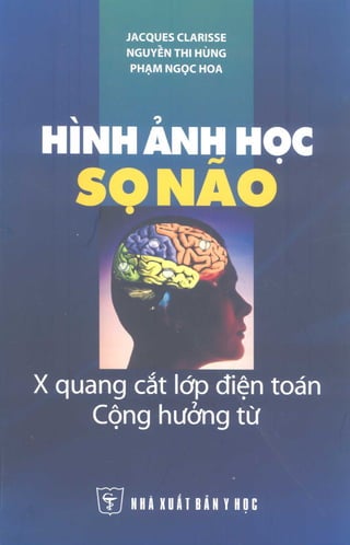 Hinh anh hoc so nao x quang cat lop