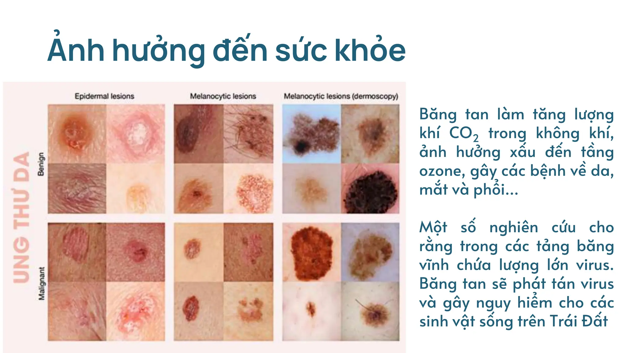 Ảnh hưởng đến sức khỏe
Băng tan làm tăng lượng
khí CO2 trong không khí,
ảnh hưởng xấu đến tầng
ozone, gây các bệnh về da,
mắt và phổi…
Một số nghiên cứu cho
rằng trong các tảng băng
vĩnh chứa lượng lớn virus.
Băng tan sẽ phát tán virus
và gây nguy hiểm cho các
sinh vật sống trên Trái Đất
 