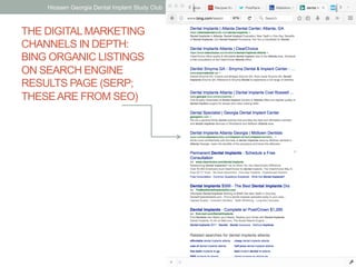 THE DIGITALMARKETING
CHANNELS IN DEPTH:
BING ORGANIC LISTINGS
ON SEARCH ENGINE
RESULTS PAGE (SERP;
THESEARE FROM SEO)
Hiossen Georgia Dental Implant Study Club | Jake Aull, ZenFires Digital Marketing 25
 