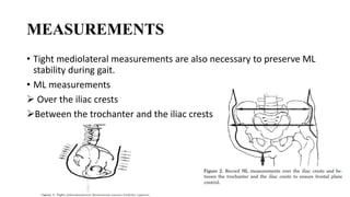 MEASUREMENTS
• Tight mediolateral measurements are also necessary to preserve ML
stability during gait.
• ML measurements
 Over the iliac crests
Between the trochanter and the iliac crests
 