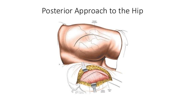 Hip Anatomy Posterior - Anatomy Drawing Diagram
