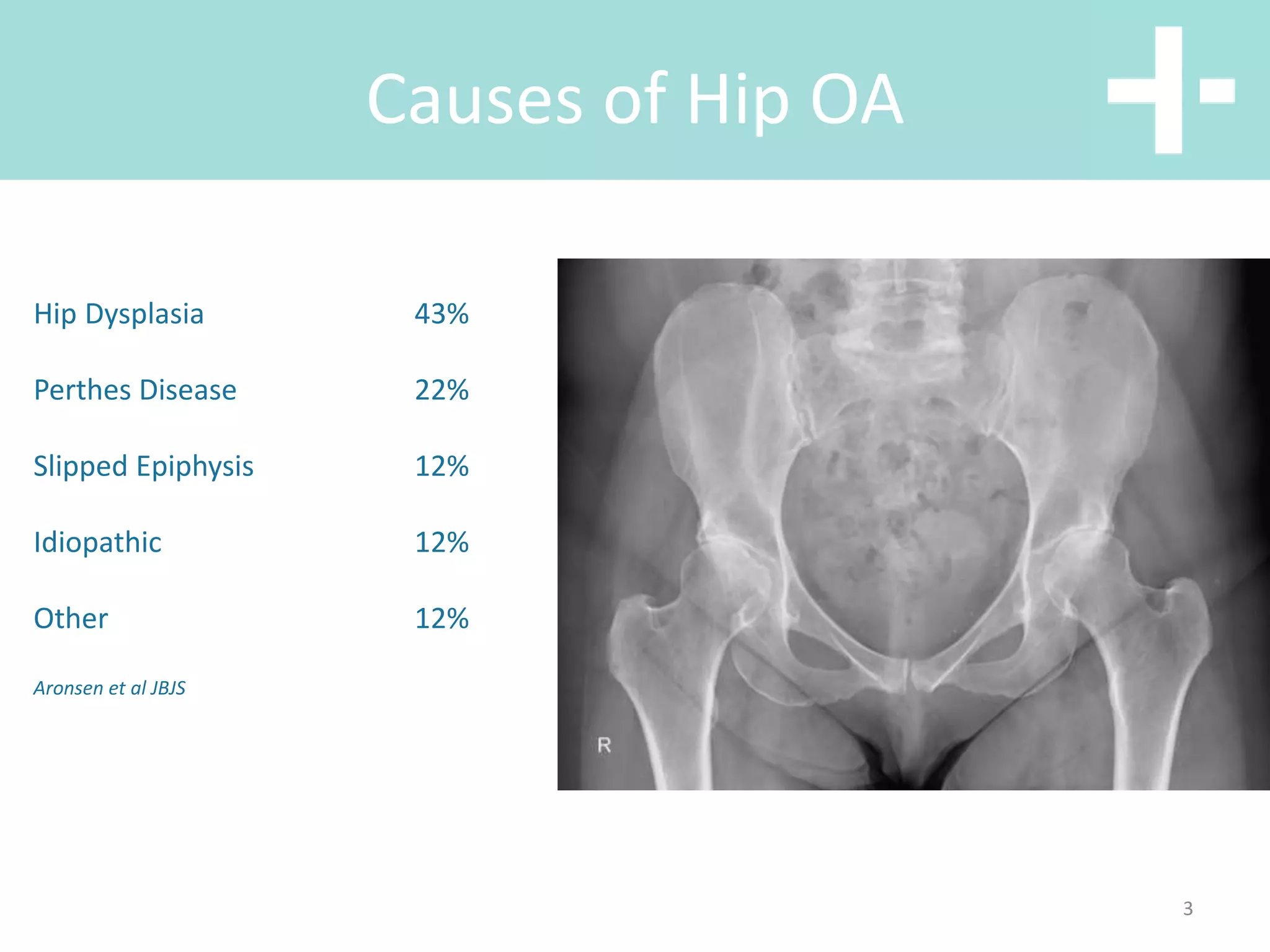 Hip anterior vs posterior total hip replacement | PPT