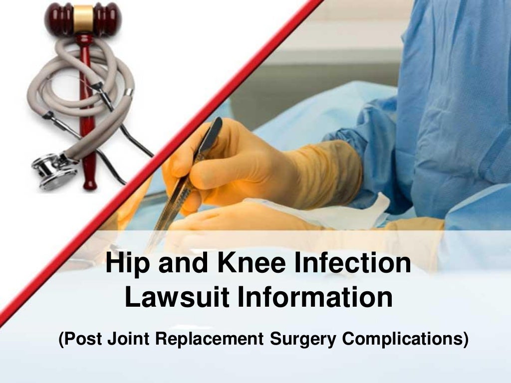 Hip & Knee Replacement Infections Lawsuit Information