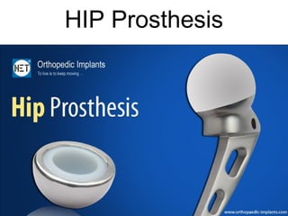 HIP Prosthesis
 