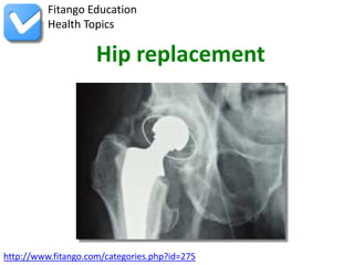 Fitango Education
          Health Topics

                     Hip replacement




http://www.fitango.com/categories.php?id=275
 