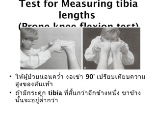 Test for Measuring tibia 
lengths 
(Prone knee flexion test) 
• ให้ผู้ป่วยนอนควำ่า งอเข่า 90° เปรียบเทียบความ 
สูงของส้นเท้า 
• ถ้ามีกระดูก tibia ทสี่นั้กว่าอีกข้างหนงึ่ ขาข้าง 
นั้นจะอยู่ตำ่ากว่า 
 
