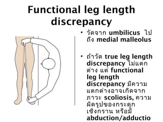 Functional leg length 
discrepancy 
• วัดจาก umbilicus ไป 
ถึง medial malleolus 
• ถ้าวัด true leg length 
discrepancy ไม่แตก 
ต่าง แต่ functional 
leg length 
discrepancy มีความ 
แตกต่างอาจเกิดจาก 
ภาวะ scoliosis, ความ 
ผิดรูปของกระดูก 
เชิงกราน หรือมี 
abduction/adductio 
n contructure ของ 
 