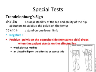 Special Tests 
Trendelenburg's Sign 
ประเมิน : Assess stability of the hip and ability of the hip 
abductors to stabilize the pelvis on the femur 
วิธีตรวจ : stand on one lower limb 
• Negative : 
• Positive : pelvis on the opposite side (nonstance side) drops 
when the patient stands on the affected leg 
– weak gluteus medius 
– an unstable hip on the affected or stance side 
 