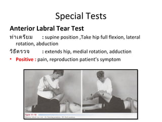 Special Tests 
Anterior Labral Tear Test 
ท่าเตรียม : supine position ,Take hip full flexion, lateral 
rotation, abduction 
วิธีตรวจ : extends hip, medial rotation, adduction 
• Positive : pain, reproduction patient’s symptom 
 