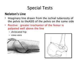 Special Tests 
Nelaton's Line 
• Imaginary line drawn from the ischial tuberosity of 
the pelvis to theASIS of the pelvis on the same side 
• Positive : greater trochanter of the femur is 
palpated well above the line 
– dislocated hip 
– coxa vara 
 