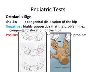 Pediatric Tests 
Ortolani's Sign 
ประเมิน : congenital dislocation of the hip 
Negative : highly suggestive that the problem (i.e., 
congenital dislocation of the hip) 
Positive : does not necessarily rule out the problem 
 