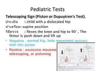 Pediatric Tests 
Telescoping Sign (Piston or Dupuytren's Test). 
ประเมิน : child with a dislocated hip 
ท่าเตรียม: supine position 
วิธีตรวจ : flexes the knee and hip to 90° , The 
femur is push down and lift up 
• Negative : normal hip, little movement occcurs 
with this action 
• Positive : excessive movement is called 
telescoping, or pistoning 
 