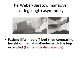 The Weber-Barstow maneuver 
for leg length asymmetry 
• Patient lifts hips off bed then comparing 
height of medial malleolus with the legs 
extended (Leg length discrepancy) 
 