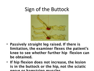 Sign of the Buttock 
• Passively straight leg raised. If there is 
limitation, the examiner flexes the patient's 
knee to see whether further hip flexion can 
be obtained. 
• If hip flexion does not increase, the lesion 
is in the buttock or the hip, not the sciatic 
nerve or hamstring muscles. 
 