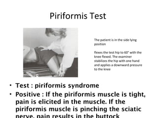Piriformis Test 
The patient is in the side lying 
position 
flexes the test hip to 60° with the 
knee flexed. The examiner 
stabilizes the hip with one hand 
and applies a downward pressure 
to the knee 
• Test : piriformis syndrome 
• Positive : If the piriformis muscle is tight, 
pain is elicited in the muscle. If the 
piriformis muscle is pinching the sciatic 
nerve, pain results in the buttock 
 