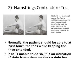2) Hamstrings Contracture Test 
Pt sit with one knee flexed 
against the chest to 
stabilize the pelvis and the 
other knee extended. 
then flex the trunk and 
touch the toes of the 
extended lower limb with 
the fingers. Repeated on 
the other side. 
• Normally, the patient should be able to at 
least touch the toes while keeping the 
knee extended. 
• If he is unable to do so, it is an indication 
of tight hamstrings on the straight leg. 
 