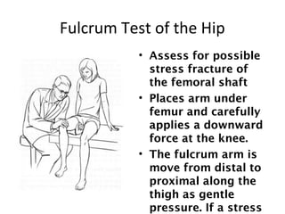 Fulcrum Test of the Hip 
• Assess for possible 
stress fracture of 
the femoral shaft 
• Places arm under 
femur and carefully 
applies a downward 
force at the knee. 
• The fulcrum arm is 
move from distal to 
proximal along the 
thigh as gentle 
pressure. If a stress 
 