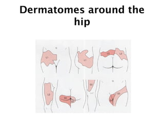Dermatomes around the 
hip 
 