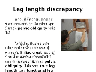 Leg length discrepancy 
ภาวะที่มีความแตกต่าง 
ของความยาวขาสองข้าง ดูว่า 
มีภาวะ pelvic obliquity หรือ 
ไม่ 
ให้ผู้ป่วยยืนตรง เท้า 
เปล่าเหยียบพื้น เข่าตรง ผู้ 
ตรวจจับที่ iliac crest ของ ผู้ 
ป่วยทงั้สองข้าง ถ้าระดับไม่ 
เท่ากัน แสดงว่ามีภาวะ pelvic 
obliquity ให้ตรวจ true leg 
length และ functional leg 
 