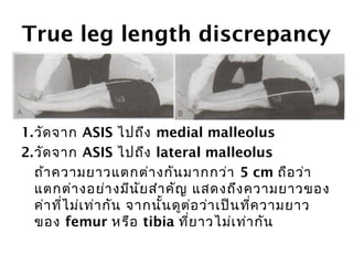 True leg length discrepancy 
1.วัดจาก ASIS ไปถึง medial malleolus 
2.วัดจาก ASIS ไปถึง lateral malleolus 
ถ้าความยาวแตกต่างกันมากกว่า 5 cm ถือว่า 
แตกต่างอย่างมีนัยสำาคัญ แสดงถึงความยาวของ 
ค่าทไี่ม่เท่ากัน จากนั้นดูต่อว่าเป็นทคี่วามยาว 
ของ femur หรือ tibia ที่ยาวไม่เท่ากัน 
 