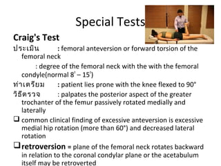 Special Tests 
Torque Test 
ประเมิน : Supine position 
ท่าเตรียม : supine close to the edge of the 
examining table with t...