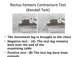 Ely's Test 
(Tight Rectus Femoris) 
• The patient lies prone, passively flexes 
the patient's knee. 
• Positive test : On ...