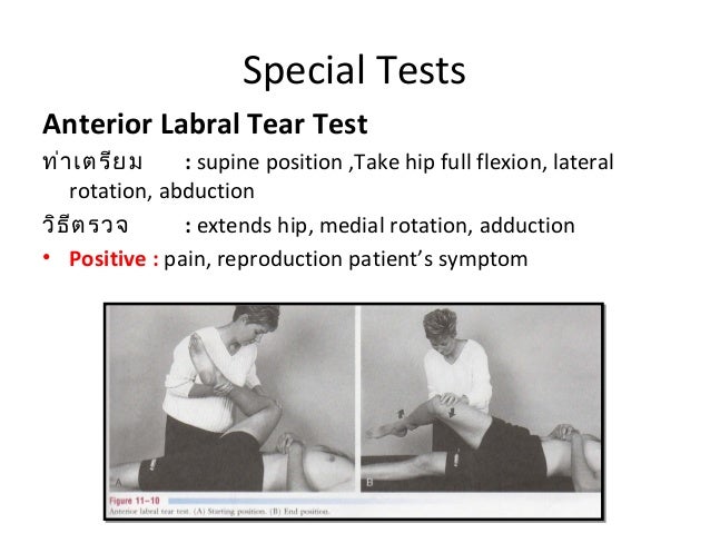 Hip Labral Tear Test