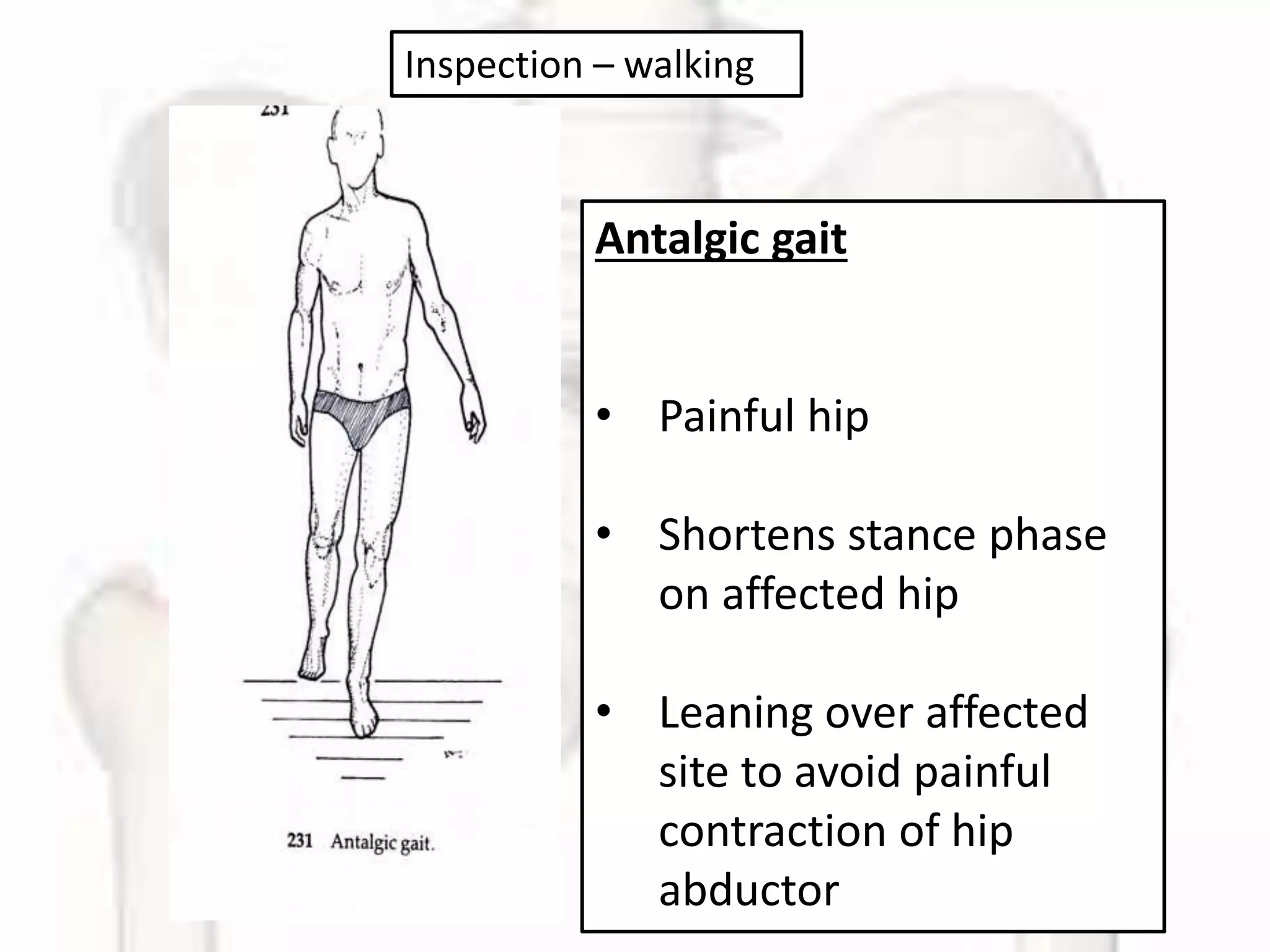 Left Antalgia HIP (1) presentation.pptx