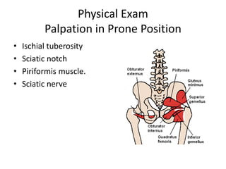 Physical Exam
Palpation in Prone Position
• Ischial tuberosity
• Sciatic notch
• Piriformis muscle.
• Sciatic nerve
 