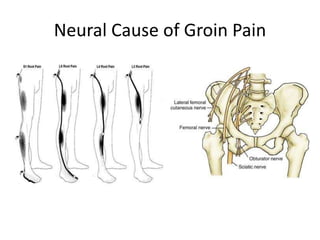 Neural Cause of Groin Pain
 