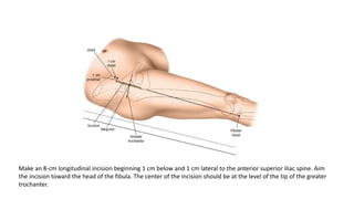 Longitudinal Incision Leg Surgical approaches to Hip.pptx