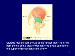 28
Gluteus medius split should be no farther than 4 to 5 cm
from the tip of the greater trochanter to avoid damage to
the superior gluteal nerve and artery
 