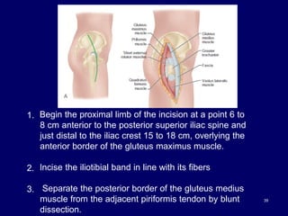 39
1. Begin the proximal limb of the incision at a point 6 to
8 cm anterior to the posterior superior iliac spine and
just distal to the iliac crest 15 to 18 cm, overlying the
anterior border of the gluteus maximus muscle.
2. Incise the iliotibial band in line with its fibers
3. Separate the posterior border of the gluteus medius
muscle from the adjacent piriformis tendon by blunt
dissection.
 