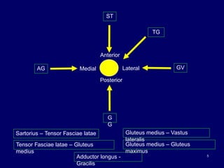 5
Anterior
Lateral
Medial
Posterior
Sartorius – Tensor Fasciae latae
Tensor Fasciae latae – Gluteus
medius
Gluteus medius – Gluteus
maximus
Adductor longus -
Gracilis
Gluteus medius – Vastus
lateralis
ST
TG
AG
G
G
GV
 